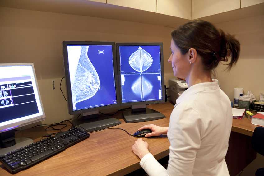 “유방 밀도 감소 속도, 유방암 발병에 영향”